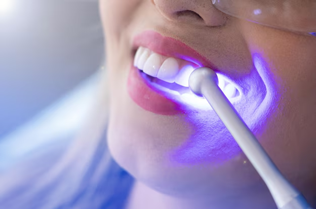 How Teeth Cleaning and Whitening in Abu Dhabi Can Give You a Confidence Boost